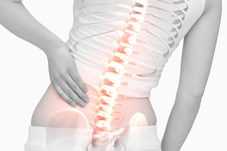 脊椎疾患イメージ画像